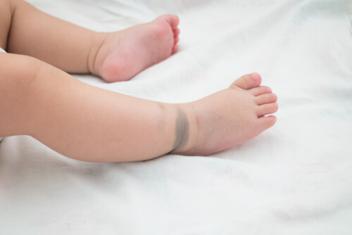 赤ちゃんの青あざ つだ小児科クリニック 小児科一般 アレルギー科 乳幼児健診 予防接種