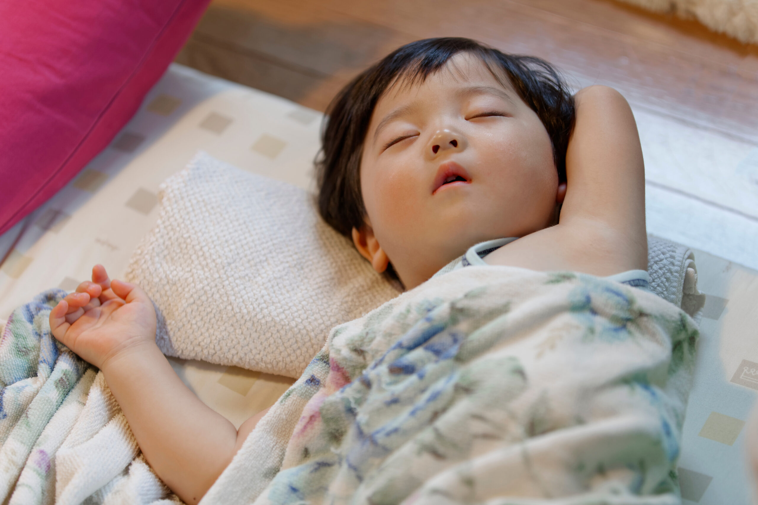閉塞性睡眠時無呼吸症候群（obstructive sleep apnea syndrome: OSAS）